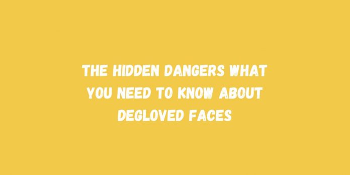 The Hidden Dangers What You Need to Know About Degloved Faces